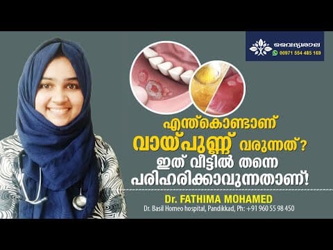 വായ്പുണ്ണ് മാറാൻ | വായ്പുണ്ണ് വരാൻ കാരണങ്ങൾ | Mouth Ulcer Home Remedy Malayalam | Vay Punn Maran