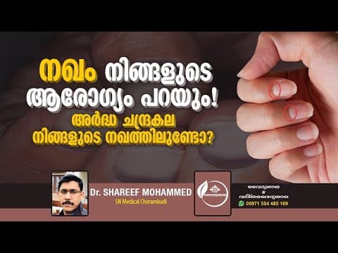 നഖം കണ്ടാൽ അറിയാം രോഗ ലക്ഷണങ്ങൾ | How to find your health problems from Nail | Dr Shareef