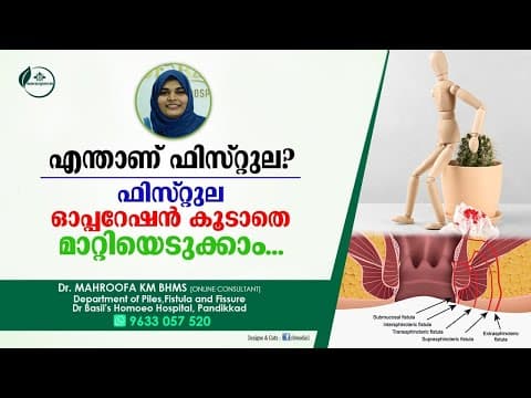 ഫിസ്റ്റുല ഓപ്പറേഷൻ കൂടാതെ മാറ്റിയെടുക്കാം | Fistula Malayalam | Dr Mahroofa