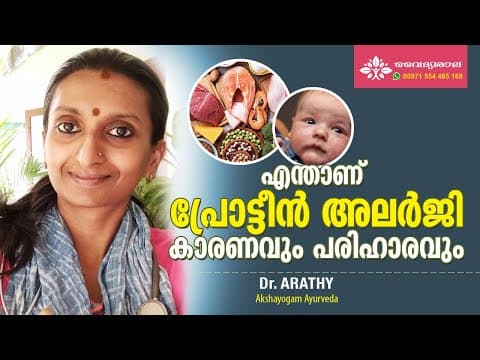 Protein Allergy Malayalam | Protein Allergy Symptoms Malayalam | പ്രോട്ടീൻ അലര്ജി | Dr Arathy