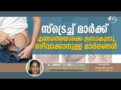 How to remove Stretch Marks | സ്ട്രെച് മാർക്സ് എങ്ങനെ മാറ്റാം | Dr Ambili TS