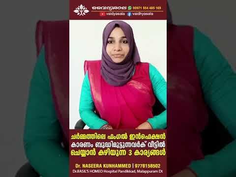 ചർമ്മത്തിലെ ഫങ്കൽ ഇൻഫെക്ഷൻ ഉള്ളവർക്ക് വീട്ടിൽ ചെയ്യാവുന്നവ | Dr Naseera