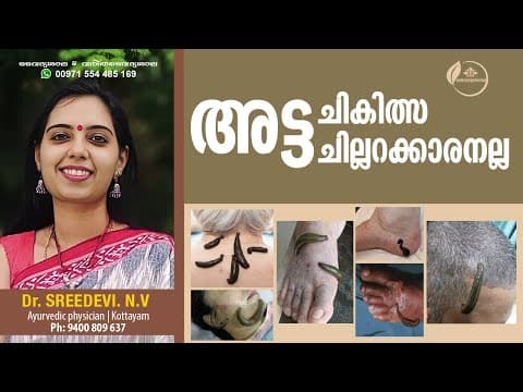 അട്ട ചികിത്സ | Leech Therapy Malayalam | Leech Therapy Benefits | Dr Sreedevi