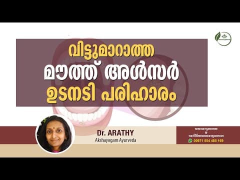 വായ്പുണ്ണ് മാറാൻ | Mouth Ulcer Treatment Malayalam | How to cure Mouth Ulcer | Dr Arathy