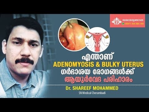 Bulky Uterus Malayalam | Adenomyosis Malayalam | Bulky Uterus എന്താണ് ? | What is Bulky Uterus